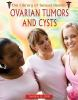 Ovarian_tumors_and_cysts