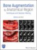 Bone_augmentation_by_anatomical_region
