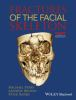 Fractures_of_the_facial_skeleton