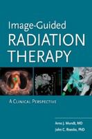 Image-guided_radiation_therapy