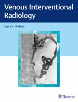 Venous_interventional_radiology