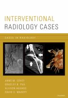 Interventional_radiology_cases
